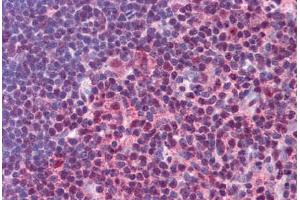 Human Thymus: Formalin-Fixed, Paraffin-Embedded (FFPE)