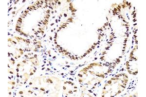 Immunohistochemistry of paraffin-embedded human stomach using PCNA antibody (ABIN1874056) at dilution of 1:100 (40x lens). (PCNA anticorps)