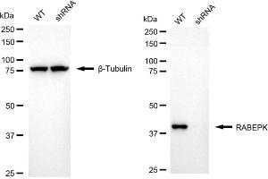 Western blotting analysis using RABEPK antibody (ABIN7800108).