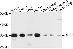 Western blot analysis of extracts of various cell lines, using CD53 antibody.