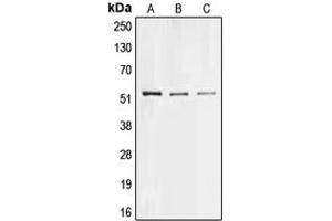 Western blot analysis of Collagen 26 alpha 1 expression in Hela (A), PC12 (B), H9C2 (C) whole cell lysates.