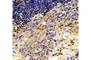 IHC analysis of FFPE human tonsil tissue stained with CD8A antibody