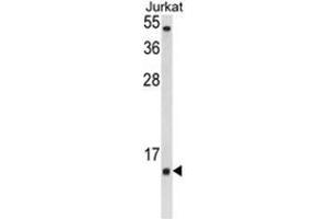Western blot analysis of SOD1 Antibody (Center) in Jurkat cell line lysates (35ug/lane). (SOD1 anticorps  (Middle Region))