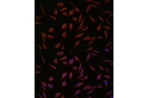 Immunofluorescence analysis of L929 cells using NXT2 antibody (ABIN6133260, ABIN6144977, ABIN6144978 and ABIN6217951) at dilution of 1:100.