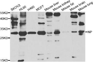 Western blot analysis of extracts of various cell lines, using PNP antibody (ABIN5973400) at 1/1000 dilution. (PNP anticorps)