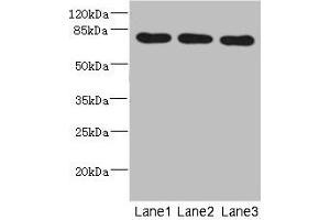 Western blot All lanes: BBS2 antibody at 5. (BBS2 anticorps  (AA 1-96))
