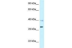 WB Suggested Anti-TNFRSF14 Antibody Titration: 1. (HVEM anticorps  (Middle Region))