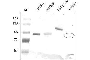 Western analysis of recombinant Human and Mouse sTIE-1 and sTIE-2 using a Polyclonal antibody directed against Mouse recombinant sTIE-1. (TIE1 anticorps  (AA 22-748))