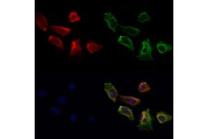 ABIN7093960 and ABIN7098004 staining Hela cells by IF/ICC.