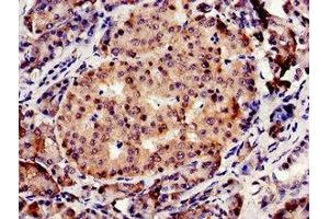 Immunocytochemistry analysis of human pancreatic tissue using ABIN7148965 at dilution of 1:100