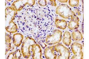 Immunohistochemistry of paraffin-embedded human kidney tissue using ABIN7147549 at dilution of 1:100 (CMKLR1 anticorps  (AA 321-373))