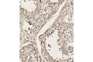 (ABIN657991 and ABIN2846937) staining Dyrk2 in human testis tissue sections by Immunohistochemistry (IHC-P - paraformaldehyde-fixed, paraffin-embedded sections).