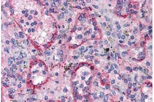 Human Spleen: Formalin-Fixed, Paraffin-Embedded (FFPE) (VTCN1 anticorps)