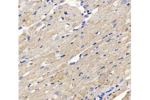 Immunohistochemistry analysis of paraffin-embedded rat heart using,DLAT (ABIN7073661) at dilution of 1: 1000 (CYB561 anticorps)