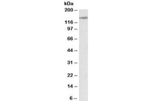 Western blot testing of human cerebellum lysate with LMTK2 antibody at 2ug/ml. (LMTK2 anticorps)