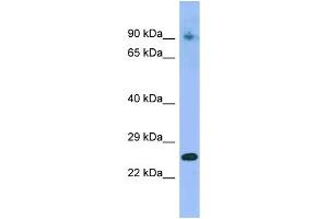 WB Suggested Anti-IFNA4 Antibody Titration: 1.