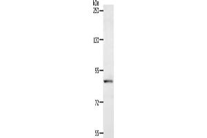 Gel: 8 % SDS-PAGE, Lysate: 40 μg, Lane: Human fetal liver tissue, Primary antibody: ABIN7128148(ACAD11 Antibody) at dilution 1/400, Secondary antibody: Goat anti rabbit IgG at 1/8000 dilution, Exposure time: 1 minute (ACAD11 anticorps)