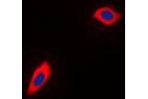 Immunofluorescent analysis of PEX11B staining in THP1 cells. (PEX11B anticorps  (Center))