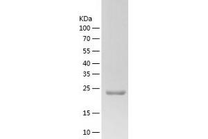 Western Blotting (WB) image for Endothelin 3 (EDN3) (AA 26-238) protein (His-IF2DI Tag) (ABIN7122782)