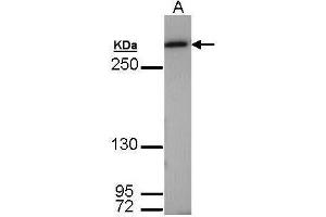 WB Image Sample (30 ug of whole cell lysate) A: Molt-4 , 7.