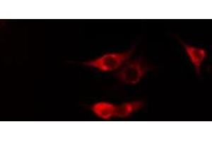 ABIN6269319 staining Hela cells by IF/ICC.