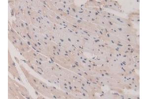 Detection of GSTM1 in Mouse Heart Tissue using Polyclonal Antibody to Glutathione S Transferase Mu 1 (GSTM1)