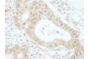 Immunohistochemistry (IHC) image for anti-TIP41-like protein (TIPRL) (C-Term) antibody (ABIN7448836) (TIPRL anticorps  (C-Term))