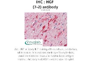 Image no. 1 for anti-Hepatocyte Growth Factor (Hepapoietin A, Scatter Factor) (HGF) antibody (ABIN1723243) (HGF anticorps)