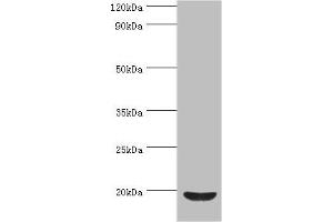 Western blot All lanes: Low molecular weight phosphotyrosine protein phosphatase antibody at 4 μg/mL + HepG2 whole cell lysate Secondary Goat polyclonal to rabbit IgG at 1/10000 dilution Predicted band size: 19, 18, 15, 13 kDa Observed band size: 19 kDa