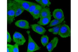 Immunofluorescence analysis of MCF-7 cells using PRKCA antibody (ABIN5997085). (PKC alpha anticorps)