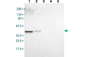 Western blot analysis of Lane 1: RT-4, Lane 2: U-251 MG, Lane 3: Human Plasma, Lane 4: Liver, Lane 5: Tonsil with ARPC1A polyclonal antibody  at 1:250-1:500 dilution. (ARPC1A anticorps)