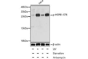 Western blot analysis of extracts of HeLa cells using Phospho-HSPB1(S78) Polyclonal Antibody at dilution of 1:1000. (HSP27 anticorps  (pSer78))