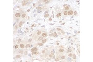 anti-AT Rich Interactive Domain 3B (BRIGHT-Like) (ARID3B) (AA 100-150) antibody