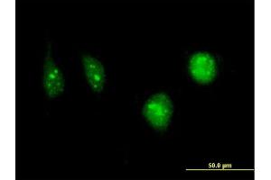 Immunofluorescence of monoclonal antibody to DCK on HeLa cell. (DCK anticorps  (AA 161-260))