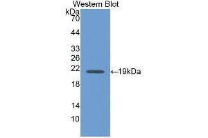 Western blot analysis of the recombinant protein. (Interferon gamma anticorps  (AA 24-167))