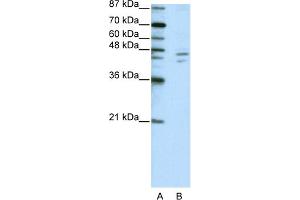 WB Suggested Anti-ZNF419A Antibody Titration:  2. (ZNF419 anticorps  (C-Term))