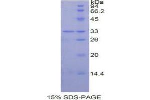 SDS-PAGE analysis of Human STAT6 Protein. (STAT6 Protéine)