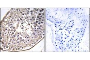 Immunohistochemistry analysis of paraffin-embedded human testis tissue, using DNAL4 Antibody. (DNAL4 anticorps  (AA 1-50))