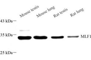 Western blot analysis of MLF1 (ABIN7074712) at dilution of 1: 500 (MLF1 anticorps)