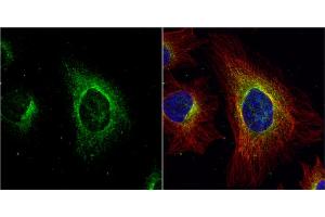 ICC/IF Image ASL antibody detects ASL protein at cytoplasm by immunofluorescent analysis. (ASL anticorps)