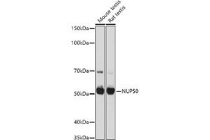 Western blot analysis of extracts of various cell lines, using NUP50 antibody (ABIN6128364, ABIN6144963, ABIN6144964 and ABIN6225005) at 1:1000 dilution. (NUP50 anticorps  (AA 299-468))
