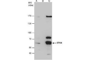 IP Image STK4 antibody immunoprecipitates STK4 protein in IP experiments.
