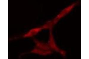 ABIN6277591 staining HeLa cells by IF/ICC. (KIF2C anticorps  (C-Term))