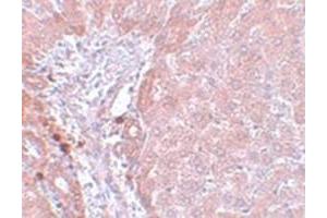Immunohistochemical staining of rat liver tissue with NDUFB9 polyclonal antibody  at 5 ug/mL dilution. (NDUFB9 anticorps  (C-Term))