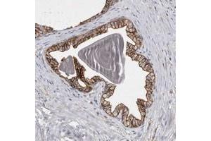 Immunohistochemical staining of human prostate with TPCN2 polyclonal antibody  shows strong membranous positivity in glandular cells.