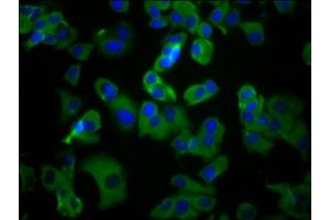 Immunofluorescence staining of MCF-7 cells with ABIN7175133 at 1:100, counter-stained with DAPI.