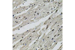 Immunohistochemistry of paraffin-embedded rat heart using CTNNB1 antibody (ABIN4903403) at dilution of 1:100 (40x lens). (CTNNB1 anticorps)