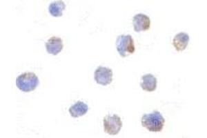 Immunocytochemistry of IKAP in A-20 cells with AP30402PU-N IKAP antibody at 1 μg/ml.