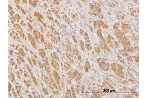 Immunoperoxidase of monoclonal antibody to MPG on formalin-fixed paraffin-embedded human adrenal gland.