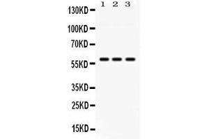 Western blot analysis of PIAS4 expression in rat testis extract ( Lane 1), mouse testis extract ( Lane 2) and HELA whole cell lysates ( Lane 3). (PIAS4 anticorps  (N-Term))